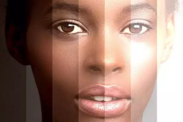 Skin Bleaching: 6 Facts You Must Know Before You Start